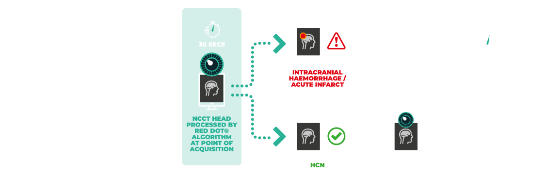 Behold AI Red Dot AI Algorithms pathway diagram showing automated diagnostic workflow